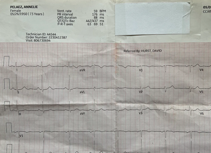 Annelie's EKG reading