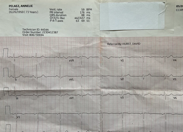 Annelie's EKG reading Annelie's EKG reading