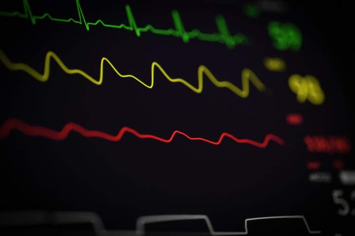 EKG reading in green yellow and red