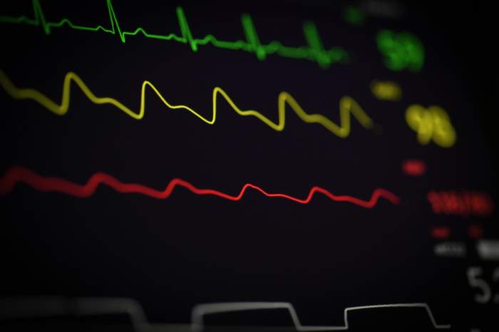 EKG reading in green yellow and red EKG reading in green yellow and red